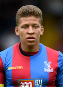 Dwight Gayle